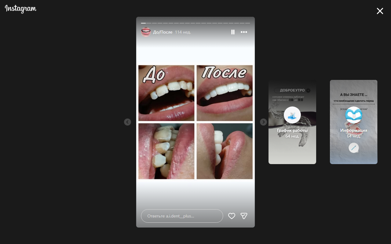 До лечения 2