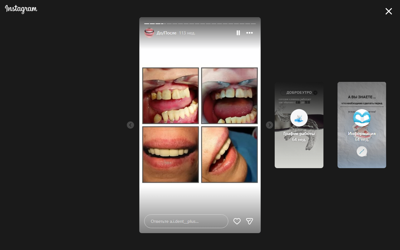 После лечения 2