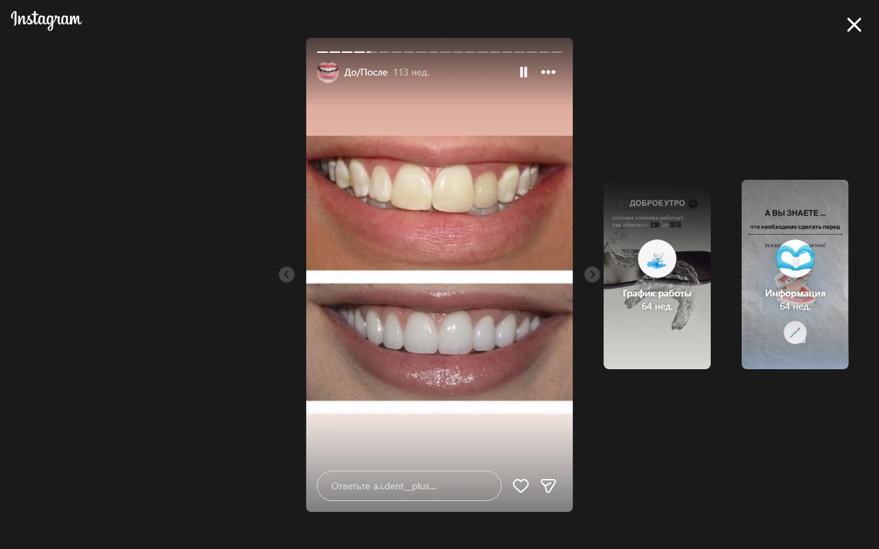 До лечения 3