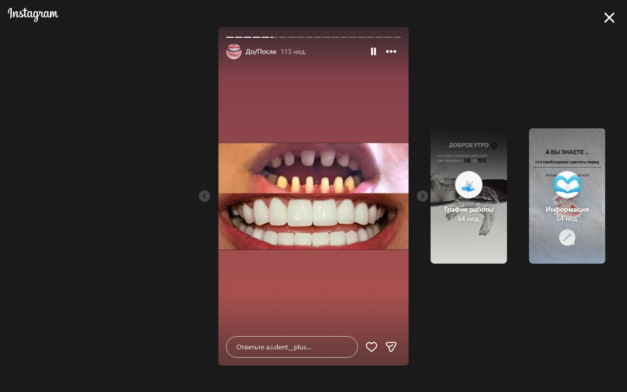 После лечения 3