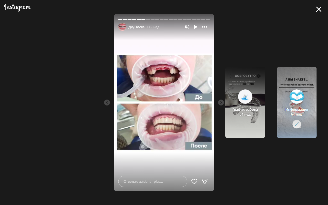 До лечения 4