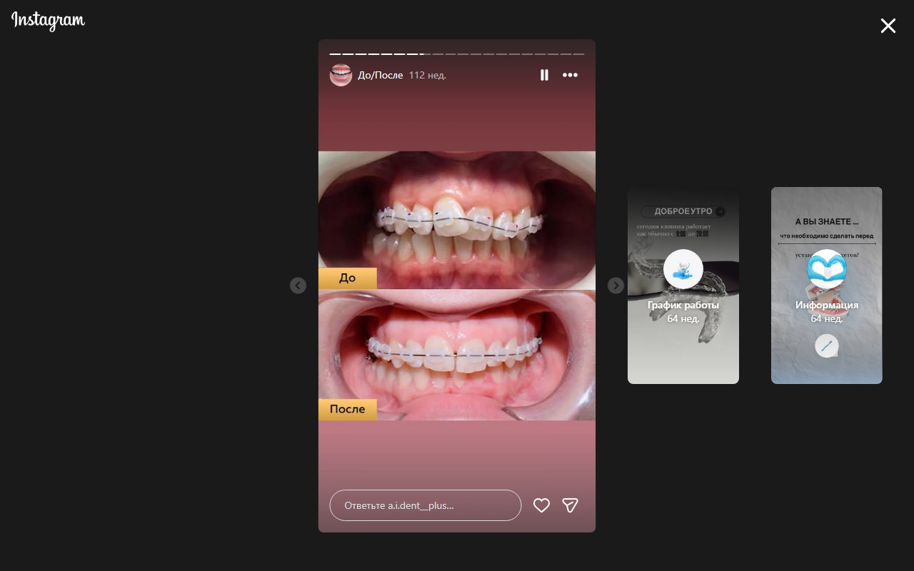 После лечения 4