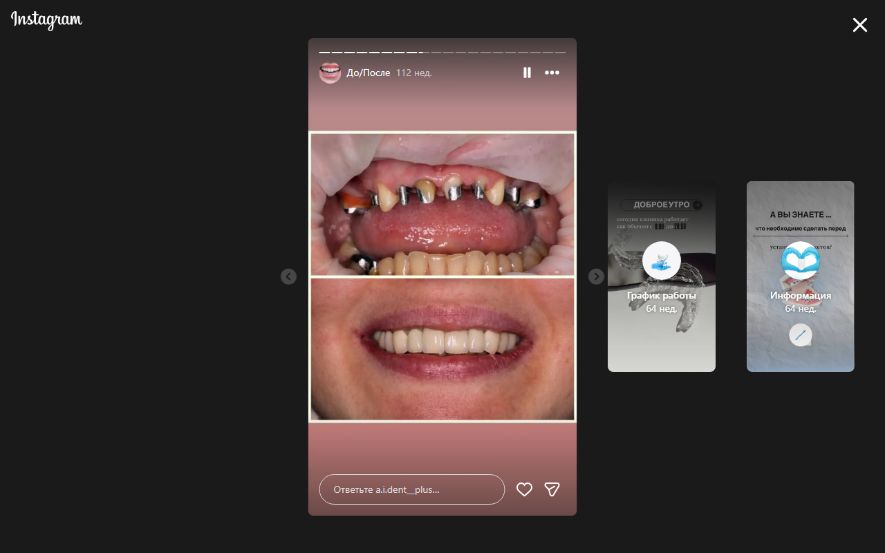 До лечения 5