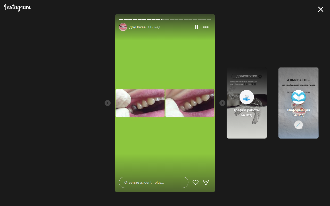 После лечения 5