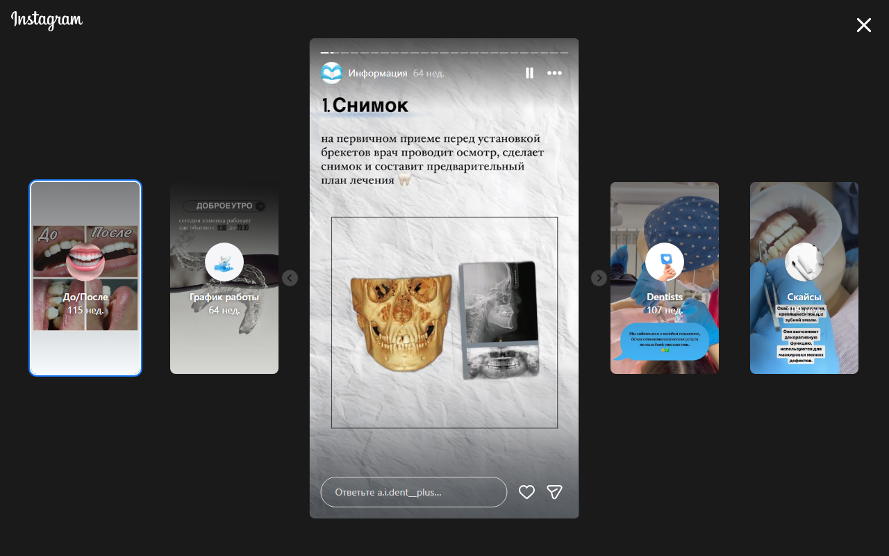 ОПТГ панорамный рентген