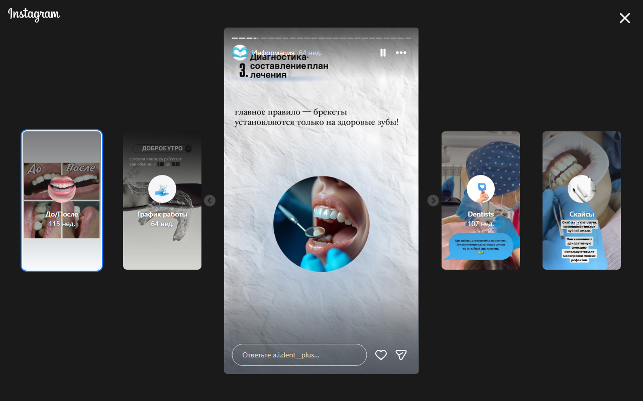 Брекет-система
