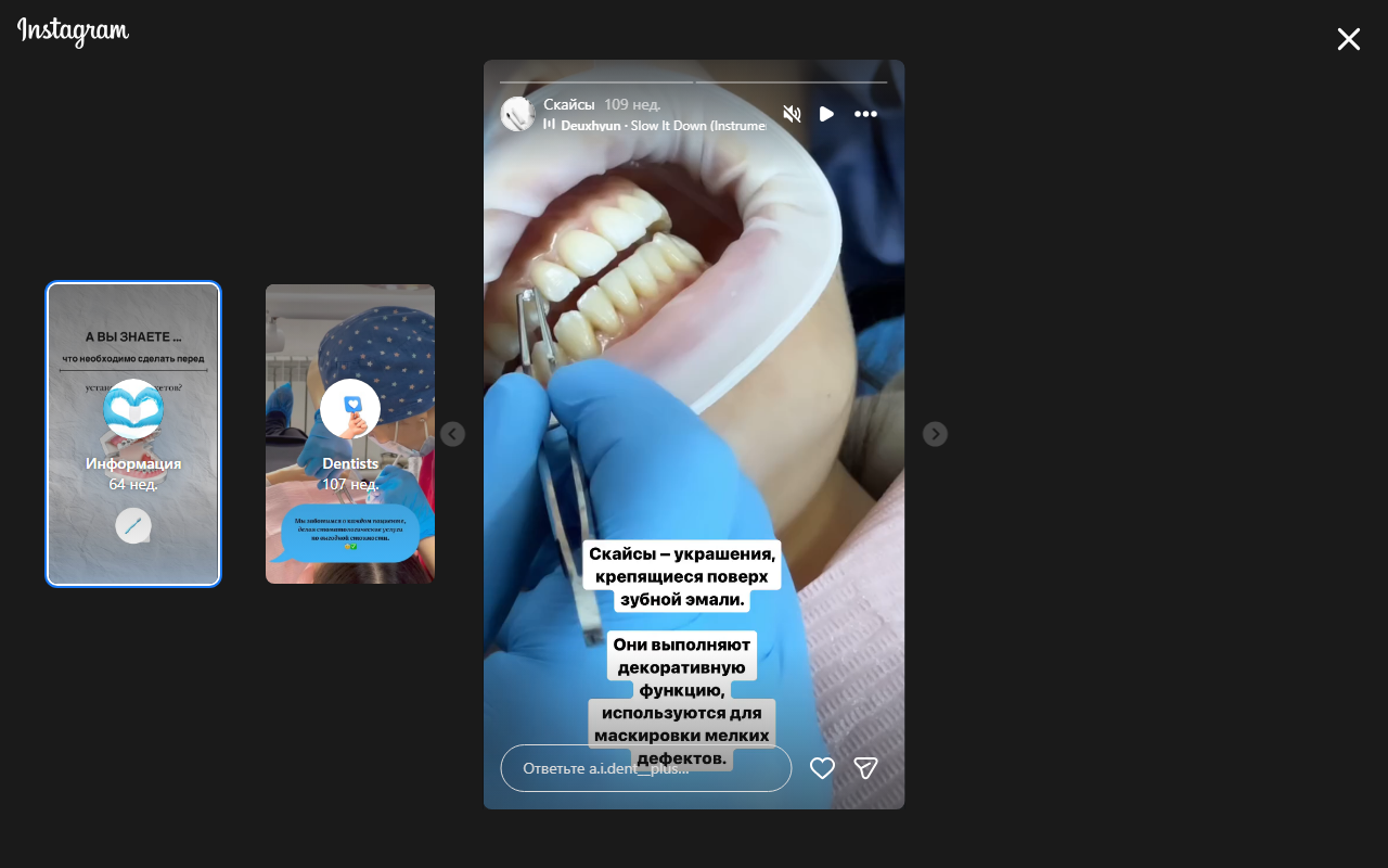 Скайсы украшения для зубов